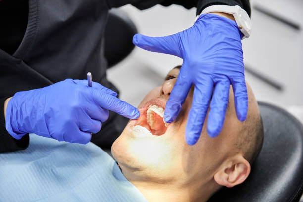 Best Emergency Root Canal Treatment in Halesite, NY